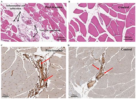 In Situ H E Staining Of The Muscle Sections Congestion Was Observed In