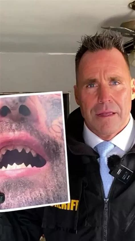 Man With SHARK TEETH Accused Of Holding Pregnant Woman As Sex Slave For Three Weeks The Mirror