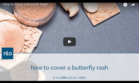 How to Cover a Lupus Butterfly Rash With Makeup - Lupus News Today