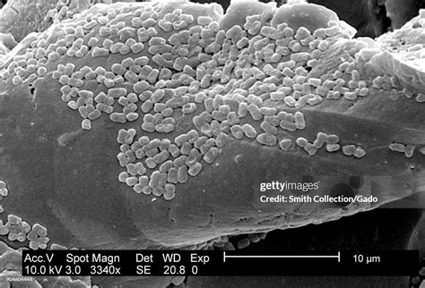 Sem Micrograph Of An E Coli Biofilm Cultivated Using A Cdc Biofilm