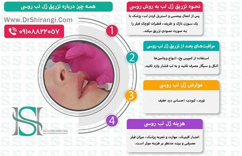 تزریق ژل لب روسی در کرج با قیمت مناسب دکتر سعید شیرنگی