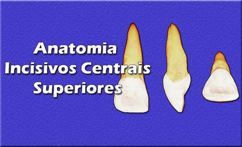 Aula De Anatomia Dental Incisivos Centrais Superiores Dente 11 E 21