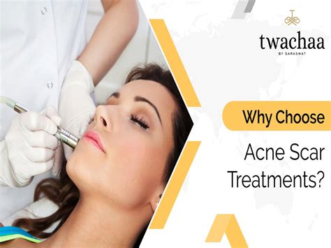 Ppt Why Choose Acne Scar Treatments Powerpoint Presentation Free To Download Id 94fe17 Owrmm