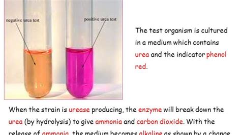 Urease Test Objective Principle Procedure And Result Online