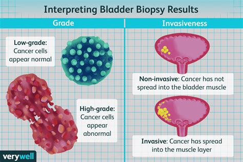 Bladder Cancer Cells