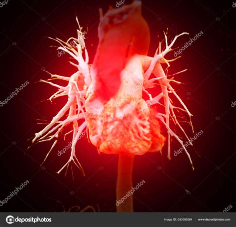 Cta Pulmonary Artery Ctpa Contrast Media Rendering Normal Pulmonary