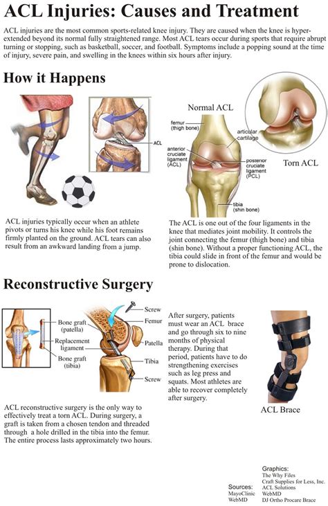 How Long Do Knee Ligament Tear Take To Heal Margaret Greene Kapsels