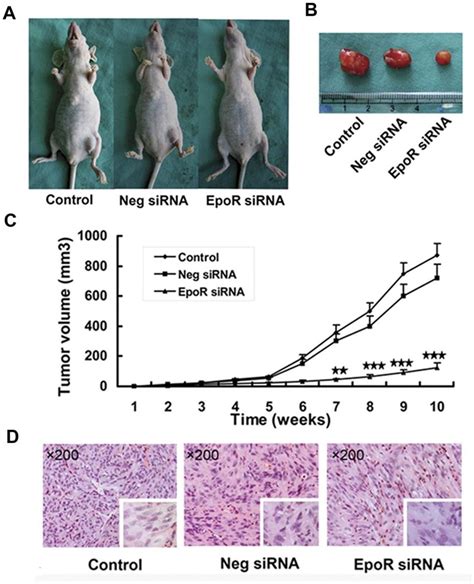 Knockdown EpoR Suppresses Tumor Growth In Nude Mice Nude Mice