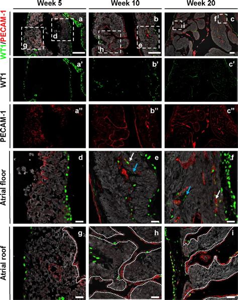 The Roadmap Of Wt1 Protein Expression In The Human Fetal Heart