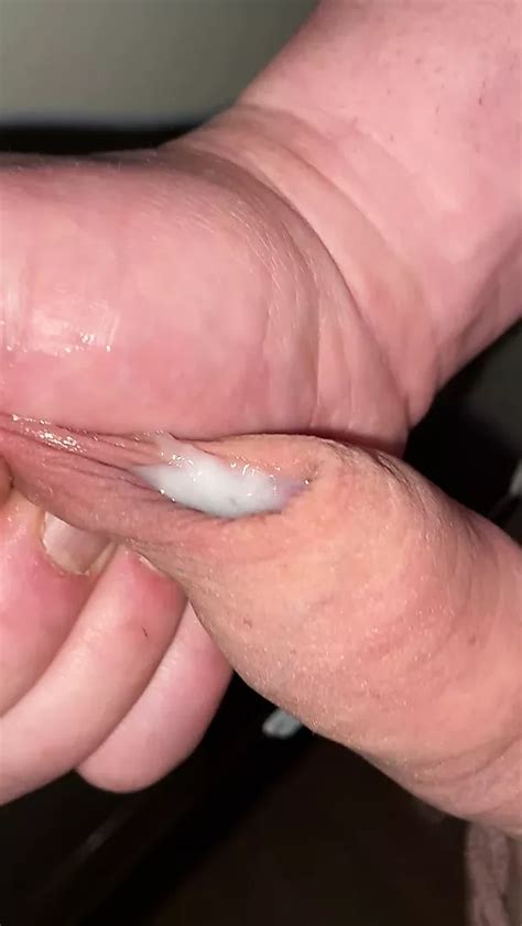 Foreskinguy Gay Porn Videos Sex Model Nudes Xhamster