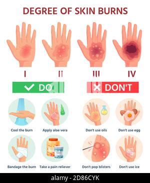 Erste Hilfe für Haut Verbrennungen Behandlung Wunden und Trauma