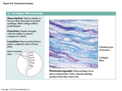 Fibrocartilage Location