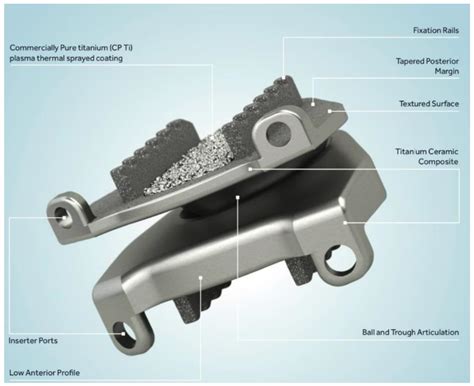 Cervical and Lumbar Disc Arthroplasty: A Review of Current Implant