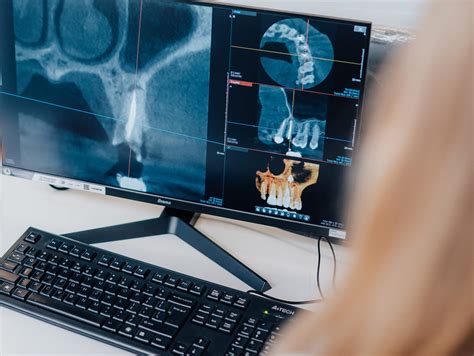 Badanie RTG Wołomin pantomogram diagnostyka rentgen zębów zdjęcie