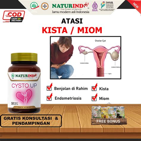 CYSTO UP Herbal Obat Kista Ovarium Obat Kista Rahim Obat Miom Obat