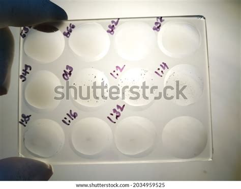 Rpr Vdrl Syphilis Test Glass Slide Stock Photo Shutterstock