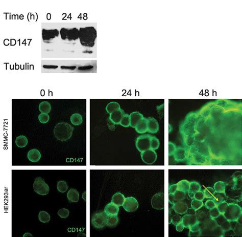 acquisition  anoikis resistance  cd upregulation