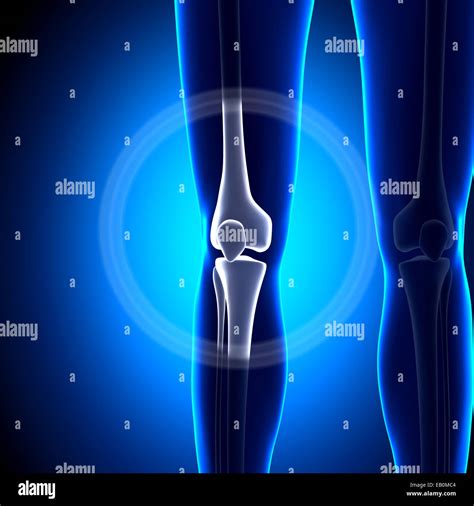 Inflamed joints hi-res stock photography and images - Alamy 
