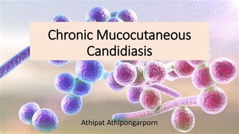 Chronic mucocutaneous candidiasis | PPT