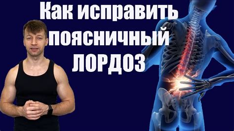 Лордоз поясничного отдела, упражнения для исправления лордоза дома ...