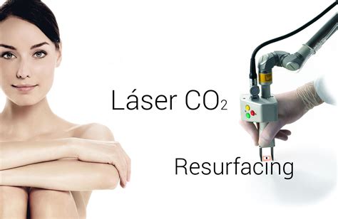 Láser Co2 Fraccionado Resurfacing Lidia Pérez Dermatólogos