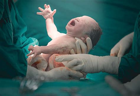 Is Sex Assigned At Birth By Colin Wright