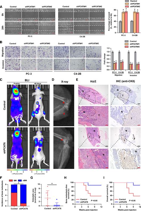 PCAT6 promotes PCa cell migration and invasion in vitro and bone ... 