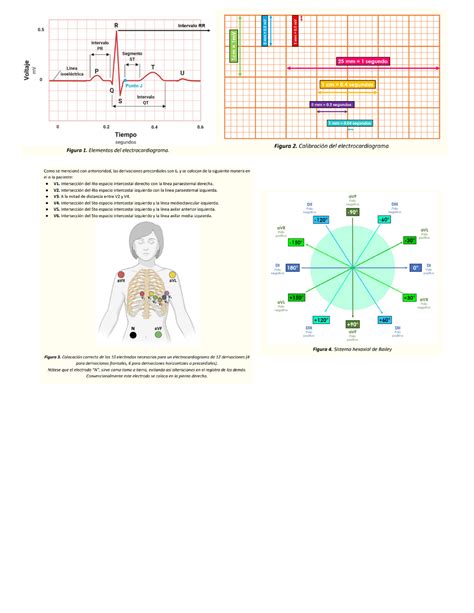 EKG Imagenes de ayuda para entender un EKG Cardiología Studocu