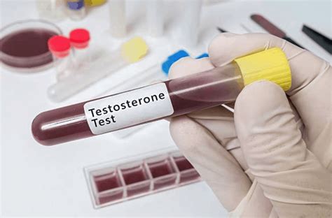 Testostérone : 6 conseils naturels pour booster votre hormone de force
