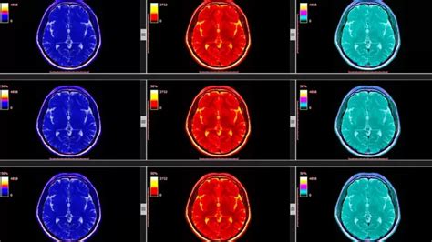 Qué nos enseña la neurociencia sobre el placer y por qué podemos