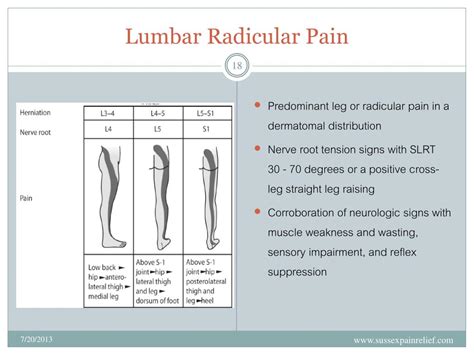 Lumbar Radicular Pattern