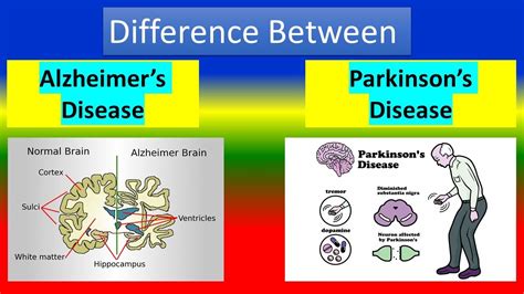 Mengenal Perbedaan Penyakit Parkinson Dan Alzheimer