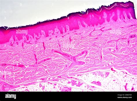 Stratified Squamous Epithelium From Human Hand Skin Showing Keratinized