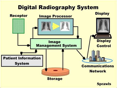 Advantages Of Digital Radiographs