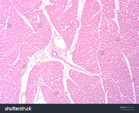 Histology Human Heart Tissue Show Cardiac Stock Photo Edit Now 639577078