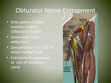 Obturator Nerve Impingement