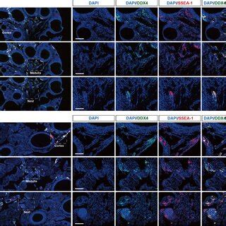 The Identification Of Putative Oogonial Stem Cells Oscs In Adult