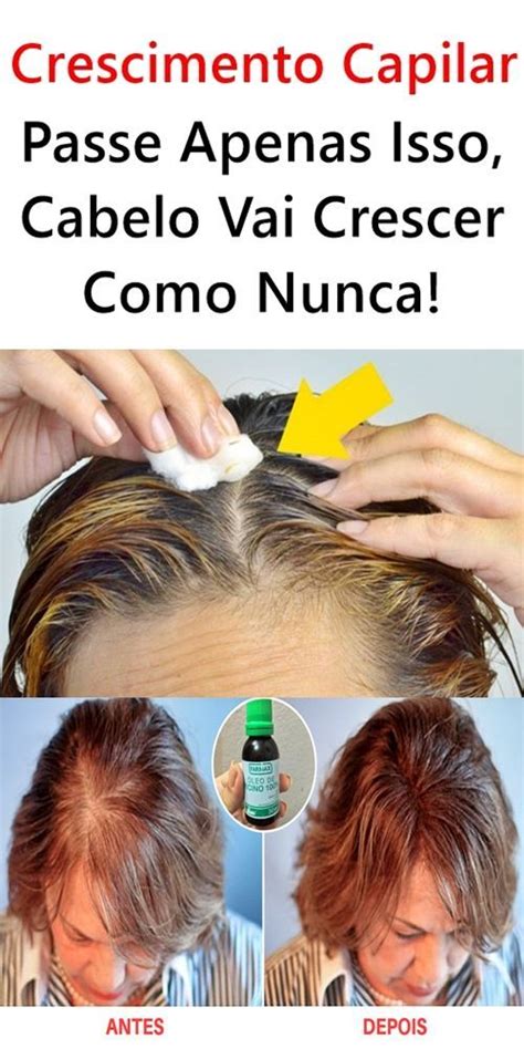 Passe Apenas Isso Cabelo Vai Crescer Como Nunca Cabelo Crescimento