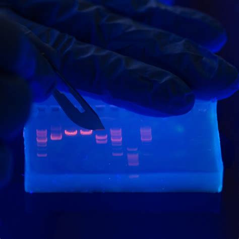 How To Interpret Dna Gel Electrophoresis Results Goldbio