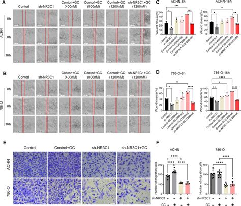 Knockdown Of Nr C Inhibits The Migration Of Ccrcc The Effect Of Nr C