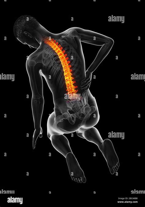 acute  pain illustration stock photo alamy