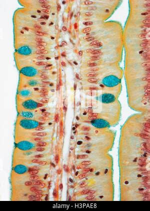 Intestinal Villi Light Micrograph Of A Section Through A Villus