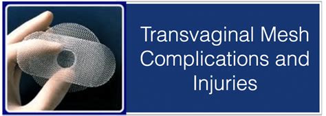 Transvaginal Mesh | Medical Device Injury Claims Attorney