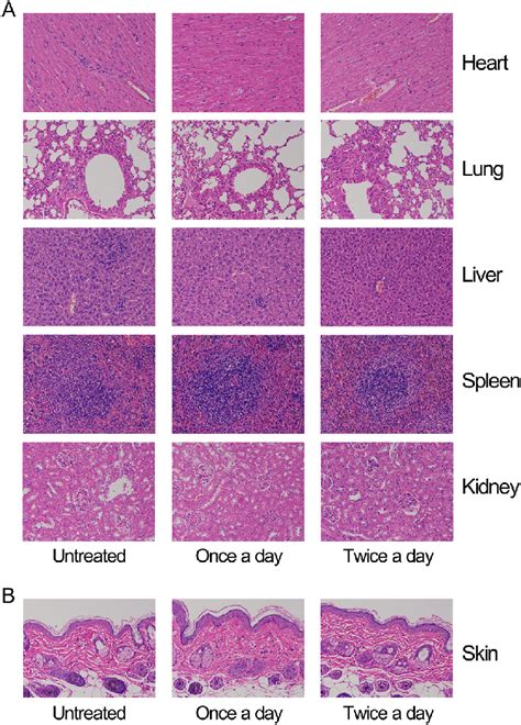 Histopathological Analysis Of The Organs From The Mice Treated With The