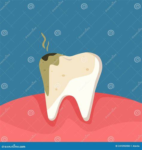 dental cavity home remedy 3
