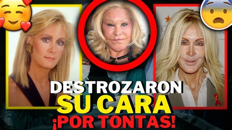 Famosas Que Arruinaron Su Cara Por Tontas Cirug As Est Ticas Que