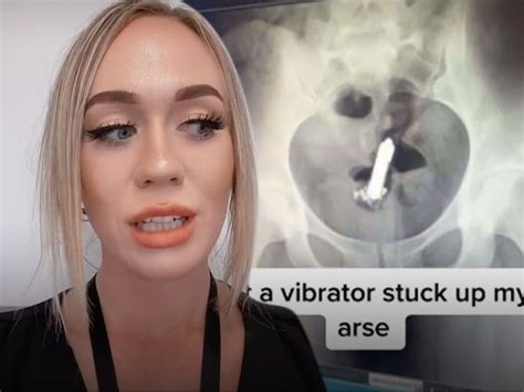 Tiktoker Had Surgery Done To Remove A Sex Toy From Her Butt Izzso News Travels Fast