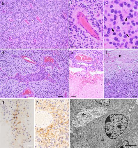 Histological Immunohistochemical And Ultrastructural Findings Of The