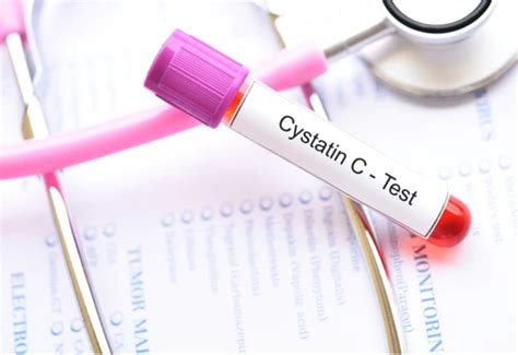 cystatin  pengertian fungsi  pentingnya  menilai kesehatan