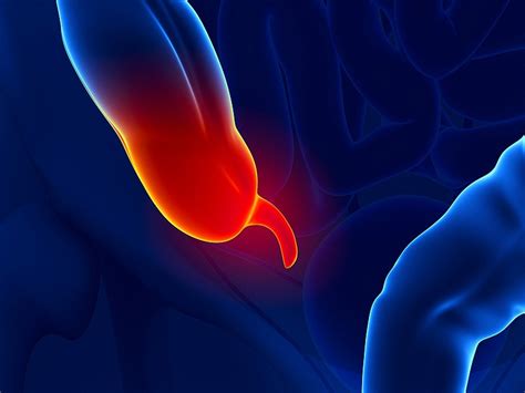 Does Appendicitis Have To Be Treated With Surgery